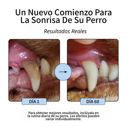 Control De La Placa Y El Sarro